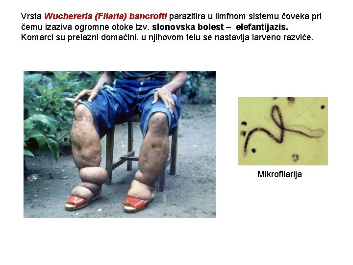 Vrsta Wuchereria (Filaria) bancrofti parazitira u limfnom sistemu čoveka pri čemu izaziva ogromne otoke