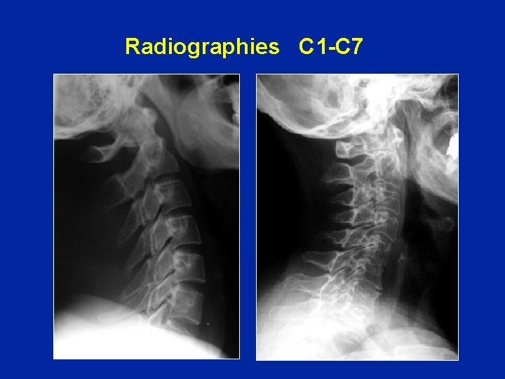 Radiographies C 1 -C 7 