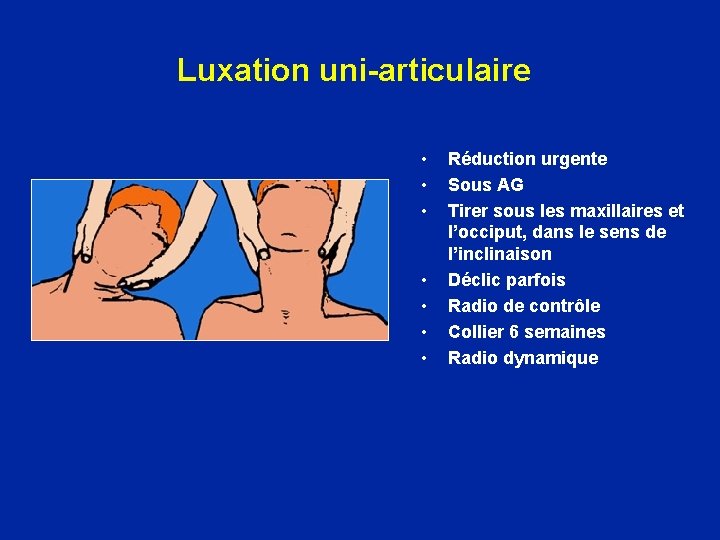 Luxation uni-articulaire • • Réduction urgente Sous AG Tirer sous les maxillaires et l’occiput,