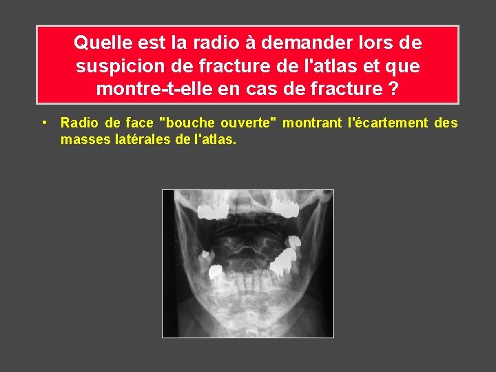 Quelle est la radio à demander lors de suspicion de fracture de l'atlas et