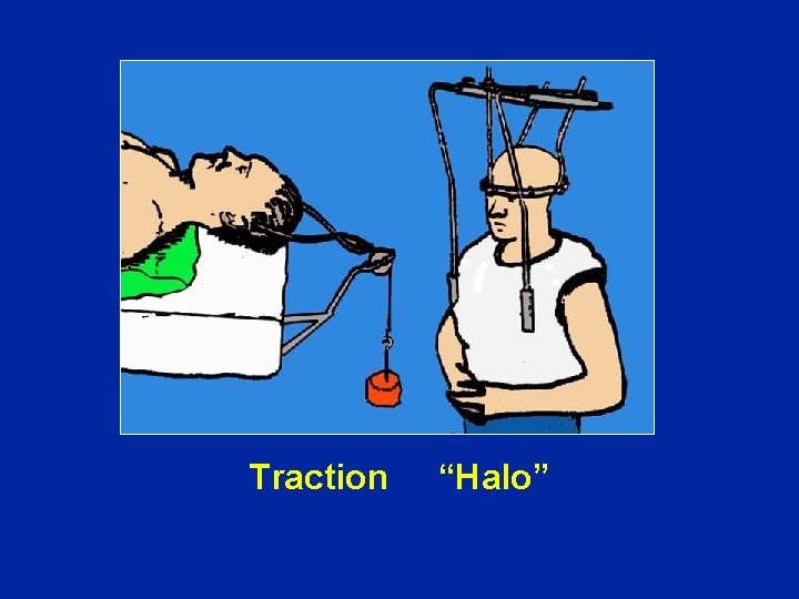 Traction “Halo” 