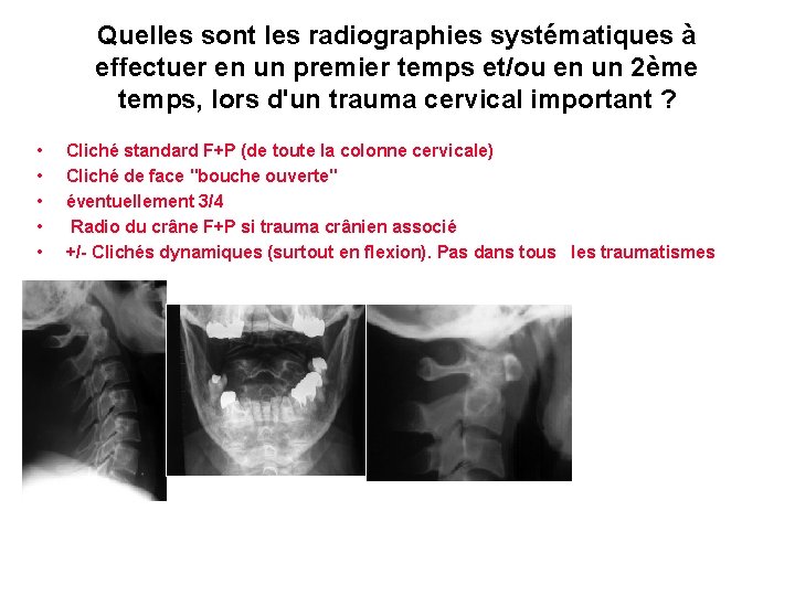 Quelles sont les radiographies systématiques à effectuer en un premier temps et/ou en un