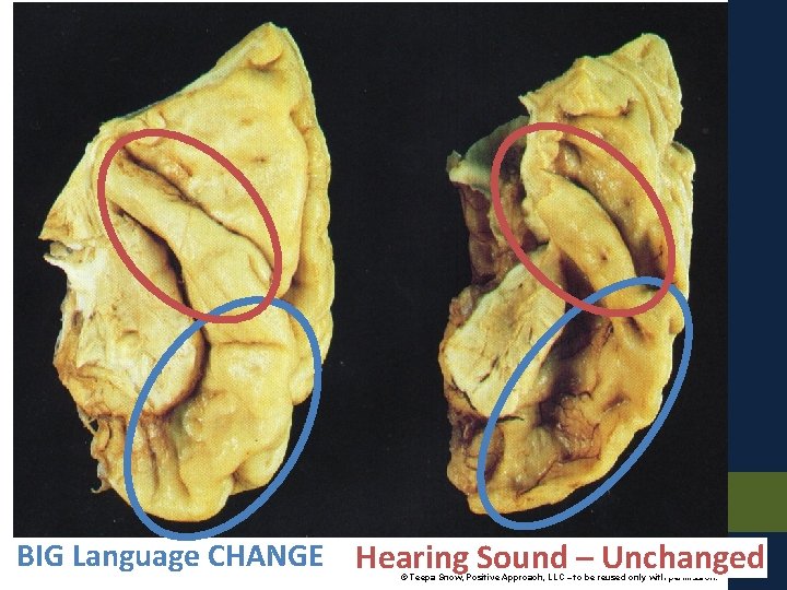 BIG Language CHANGE Hearing Sound – Unchanged © Teepa Snow, Positive Approach, LLC –