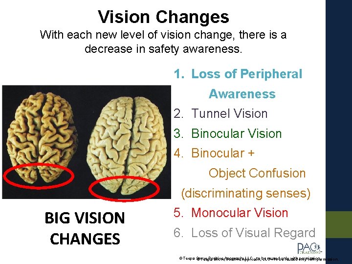 Vision Changes With each new level of vision change, there is a decrease in