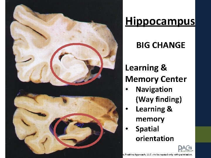 Hippocampus BIG CHANGE Learning & Memory Center • Navigation (Way finding) • Learning &
