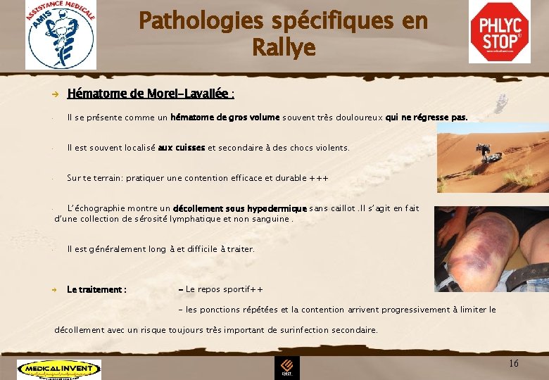 Pathologies spécifiques en Rallye è Hématome de Morel-Lavallée : • Il se présente comme Pathologies spécifiques en Rallye è Hématome de Morel-Lavallée : • Il se présente comme