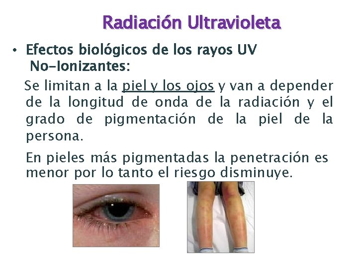 Radiación Ultravioleta • Efectos biológicos de los rayos UV No-Ionizantes: Se limitan a la