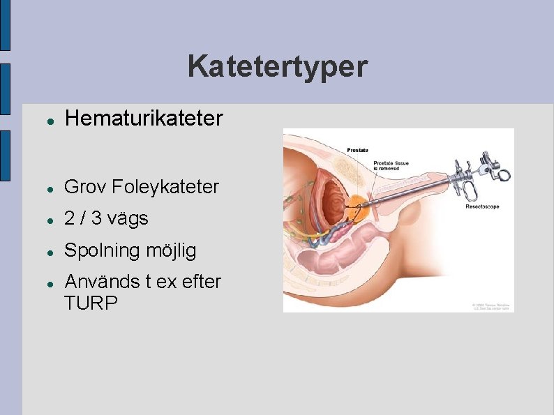 Katetertyper Hematurikateter Grov Foleykateter 2 / 3 vägs Spolning möjlig Används t ex efter Katetertyper Hematurikateter Grov Foleykateter 2 / 3 vägs Spolning möjlig Används t ex efter