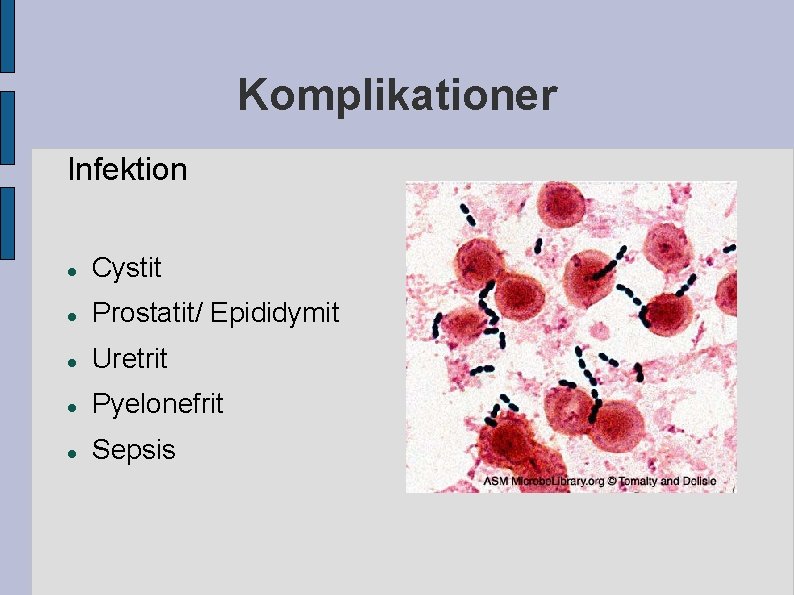 Komplikationer Infektion Cystit Prostatit/ Epididymit Uretrit Pyelonefrit Sepsis Komplikationer Infektion Cystit Prostatit/ Epididymit Uretrit Pyelonefrit Sepsis