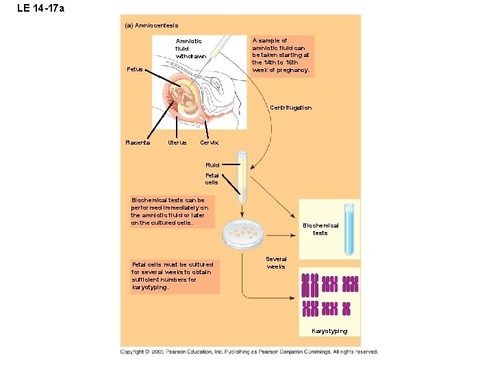 LE 14 -17 a Amniocentesis Amniotic fluid withdrawn Fetus A sample of amniotic fluid
