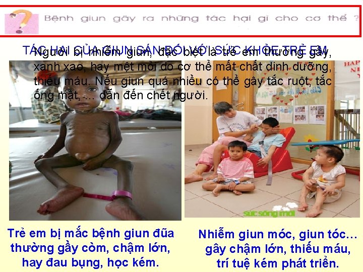 TÁC HẠI bị CỦA GIUN SÁNđặc ĐỐIbiệt VỚIlàSỨC KHỎE TRẺ gầy, EM Người nhiễm