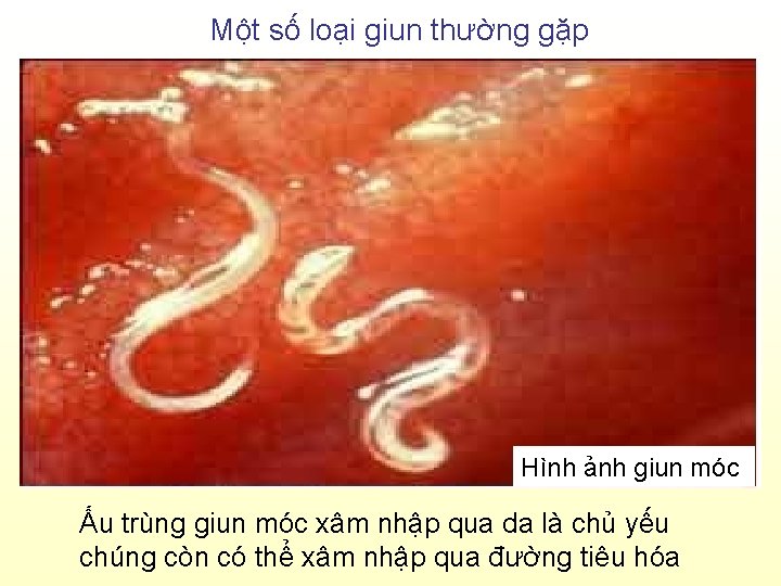 Một số loại giun thường gặp Hình ảnh giun móc Ấu trùng giun móc