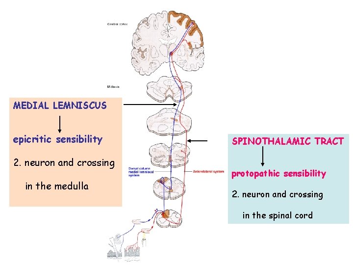 MEDIAL LEMNISCUS epicritic sensibility 2. neuron and crossing in the medulla SPINOTHALAMIC TRACT protopathic