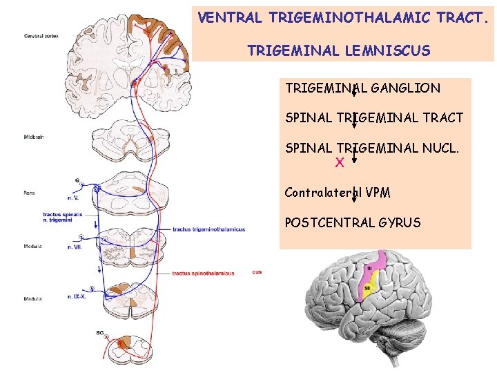 VENTRAL TRIGEMINOTHALAMIC TRACT. TRIGEMINAL LEMNISCUS TRIGEMINAL GANGLION SPINAL TRIGEMINAL TRACT SPINAL TRIGEMINAL NUCL. X