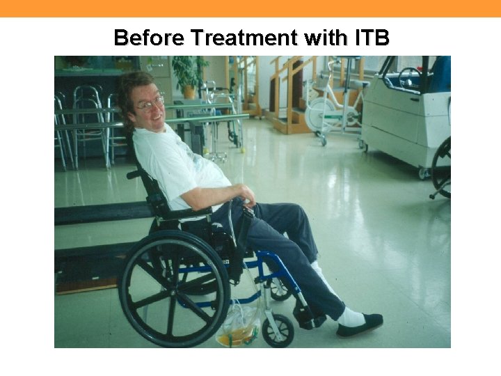 Before Treatment with ITB 