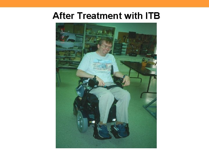 After Treatment with ITB 