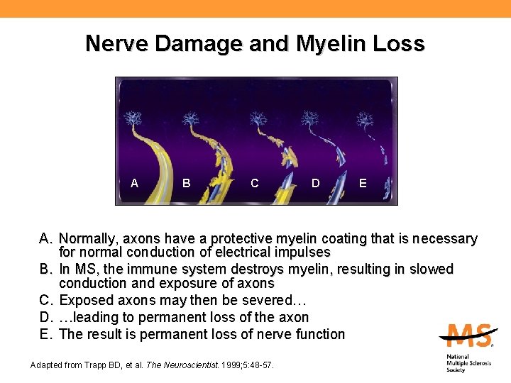 Nerve Damage and Myelin Loss A B C D E A. Normally, axons have