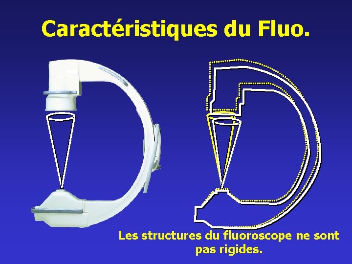 Caractéristiques du Fluo. Les structures du fluoroscope ne sont pas rigides. 