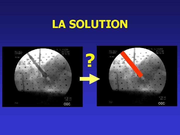 LA SOLUTION ? 