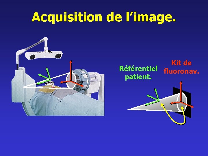 Acquisition de l’image. Kit de Référentiel fluoronav. patient. 