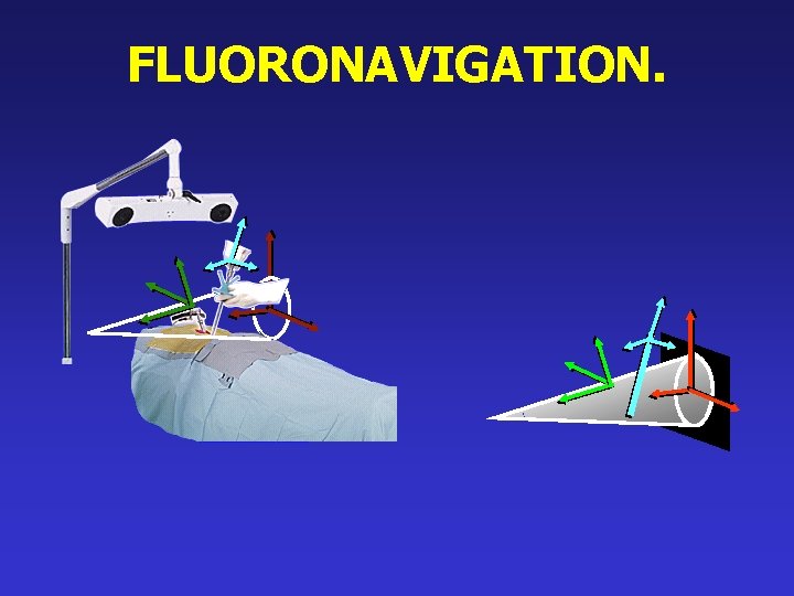 FLUORONAVIGATION. 