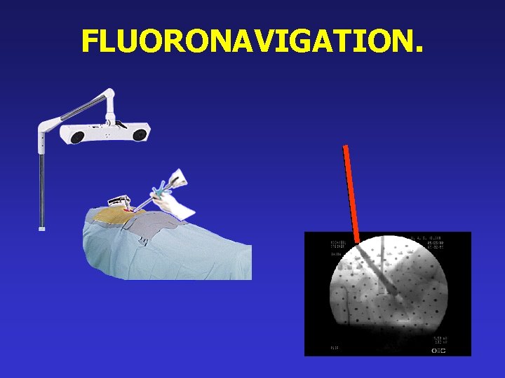 FLUORONAVIGATION. 