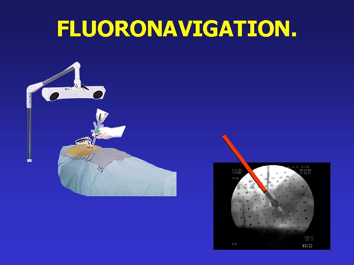 FLUORONAVIGATION. 