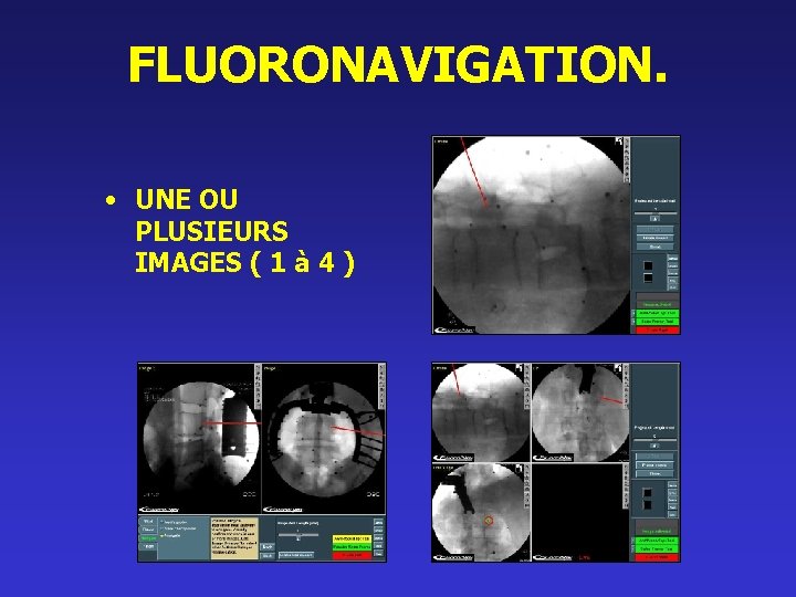 FLUORONAVIGATION. • UNE OU PLUSIEURS IMAGES ( 1 à 4 ) 