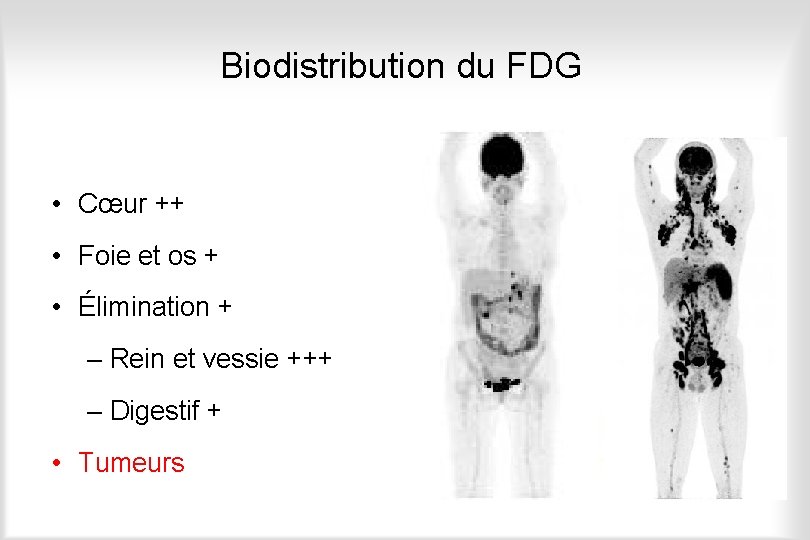 Biodistribution du FDG • Cerveau +++ • Cœur ++ • Foie et os +