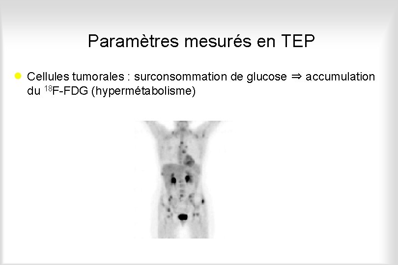 Paramètres mesurés en TEP · Cellules tumorales : surconsommation de glucose ⇒ accumulation du