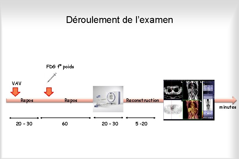 Déroulement de l’examen FDG f° poids VAV Repos Reconstruction minutes 20 – 30 60