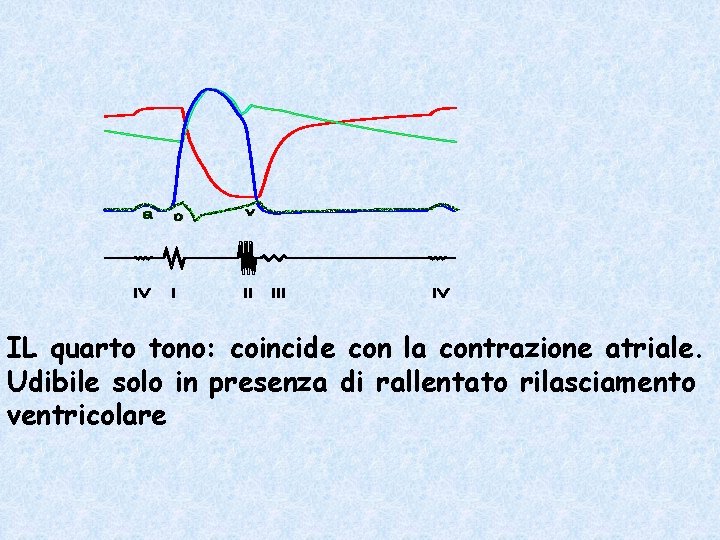 IL quarto tono: coincide con la contrazione atriale. Udibile solo in presenza di rallentato