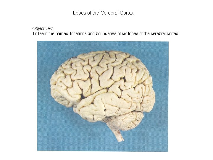 Lobes of the Cerebral Cortex Objectives: To learn the names, locations and boundaries of