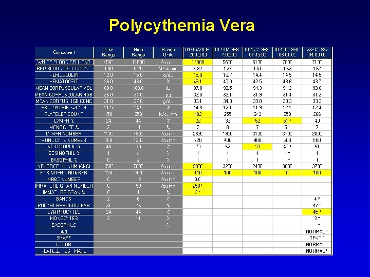 Polycythemia Vera Polycythemia Vera