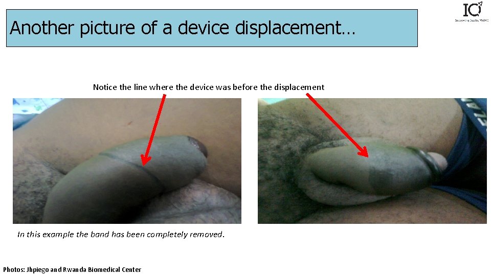 Another picture of a device displacement… Notice the line where the device was before