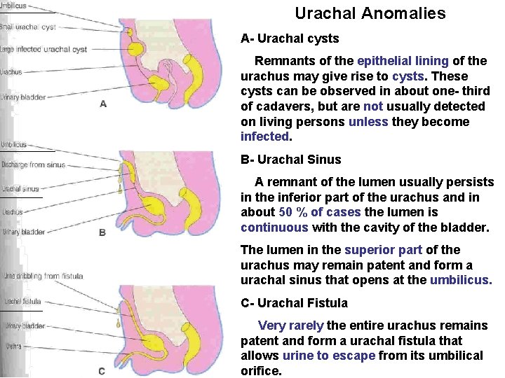 Urachal Anomalies A- Urachal cysts Remnants of the epithelial lining of the urachus may