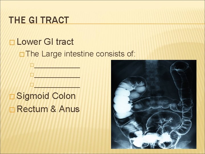 THE GI TRACT � Lower � The GI tract Large intestine consists of: �