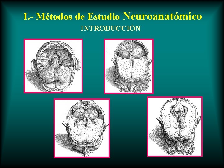 I. - Métodos de Estudio Neuroanatómico INTRODUCCIÓN 