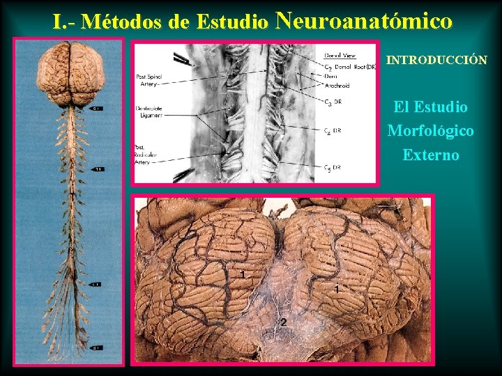 I. - Métodos de Estudio Neuroanatómico INTRODUCCIÓN El Estudio Morfológico Externo 