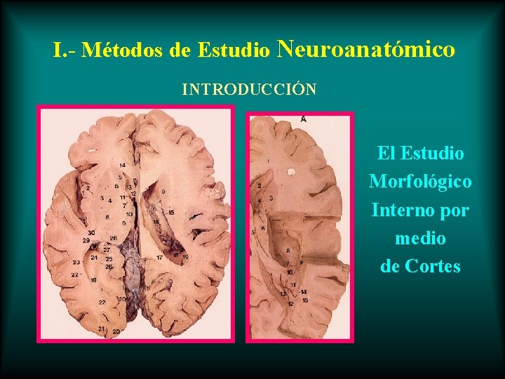 I. - Métodos de Estudio Neuroanatómico INTRODUCCIÓN El Estudio Morfológico Interno por medio de