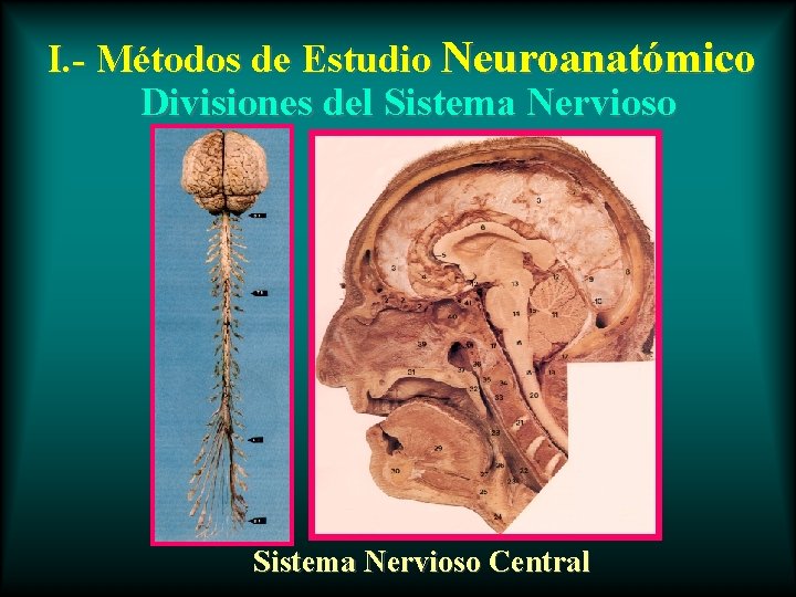 I. - Métodos de Estudio Neuroanatómico Divisiones del Sistema Nervioso Central 