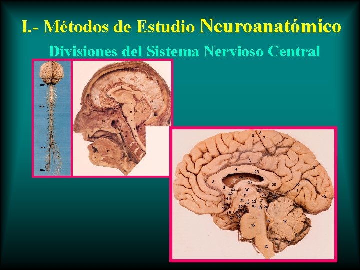 I. - Métodos de Estudio Neuroanatómico Divisiones del Sistema Nervioso Central 