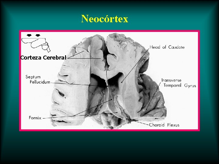 Neocórtex Corteza Cerebral 