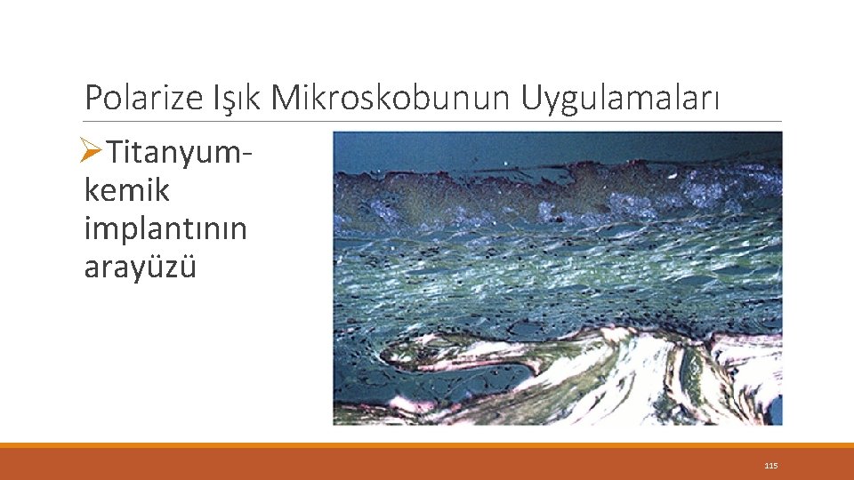 Polarize Işık Mikroskobunun Uygulamaları ØTitanyumkemik implantının arayüzü 115 Polarize Işık Mikroskobunun Uygulamaları ØTitanyumkemik implantının arayüzü 115