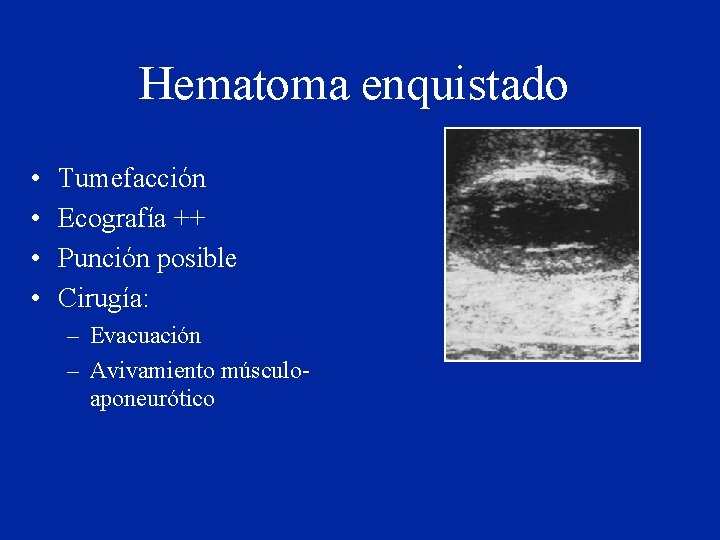 Hematoma enquistado • • Tumefacción Ecografía ++ Punción posible Cirugía: – Evacuación – Avivamiento