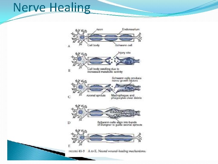 Nerve Healing 