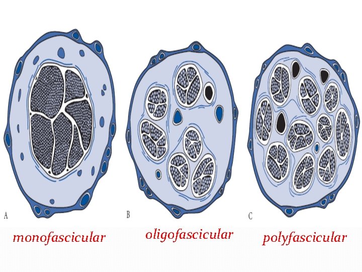 monofascicular oligofascicular polyfascicular monofascicular oligofascicular polyfascicular