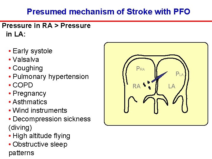 Presumed mechanism of Stroke with PFO Pressure in RA > Pressure in LA: •