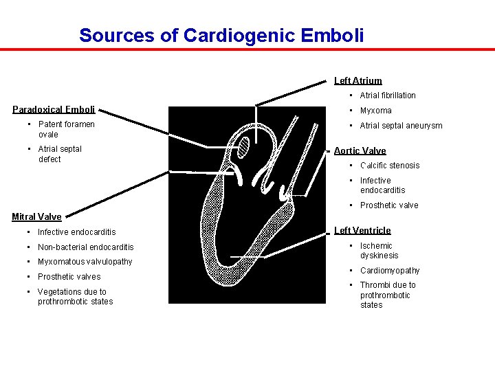 Sources of Cardiogenic Emboli Left Atrium • Atrial fibrillation Paradoxical Emboli • Patent foramen