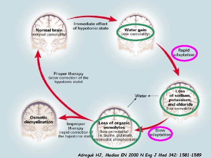 i. e. taurine, glutamate, myoinositol, phosphocreatin Adroguè HJ, Madias EN 2000 N Eng J
